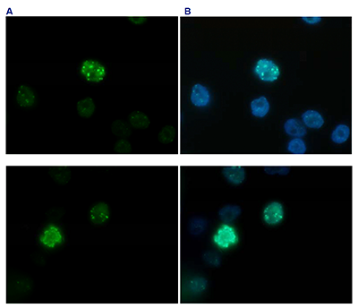 H3K27me3S28p Antibody validated in Immunofluorescence