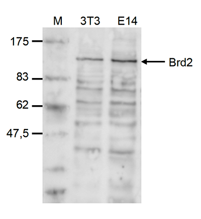 Western blot