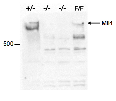 Western blot