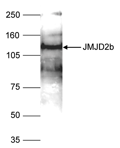 Western Blot