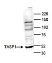 Western blot