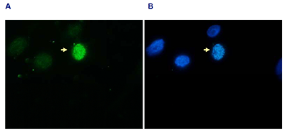 H3S10p Antibody validated in Immunofluorescence