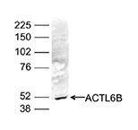 Western blot