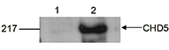 Western blot