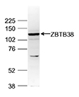 Western blot