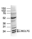 Western blot