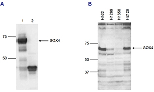 Western blot