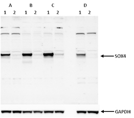 Western blot