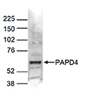 Western blot