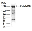 Western blot