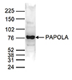 Western blot