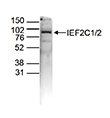 Western blot