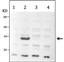 Western blot