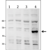 Western blot