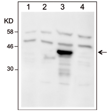 Western blot