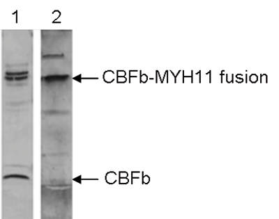 MYH11 Antibody validated in Western Blot