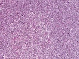 NFKB p65 Antibody validated in Immunohistochemistry