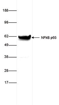 NFKB p65 Antibody validated in Western Blot