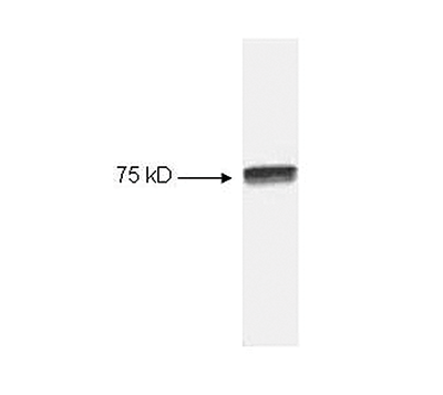 Western Blot