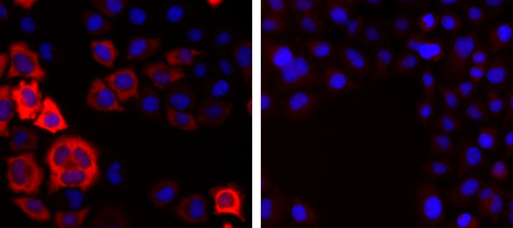 CRISPR/Cas9 Antibody Validation in IF