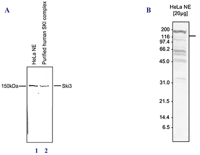 Ski3 Antibody validated in Western blot