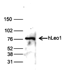 Western blot