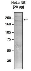 Western blot