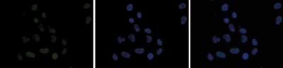 H4K5,8,12ac Antibody validated for Immunofluorescence