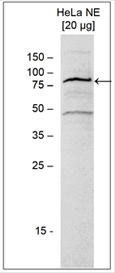 Western blot