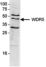 Western blot