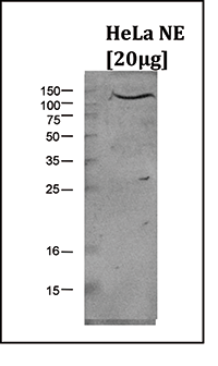 Western Blot