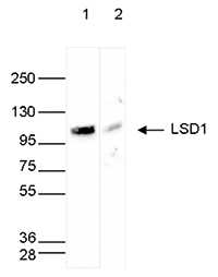 Western Blot