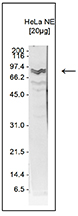 Western blot