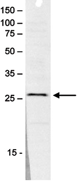 SAP30 Antibody validated in Western blot