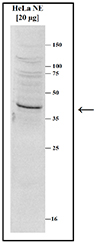 Western blot