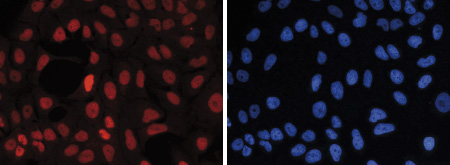 H3K27me1 Antibody validated in Immunofluorescence