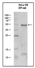 Western blot