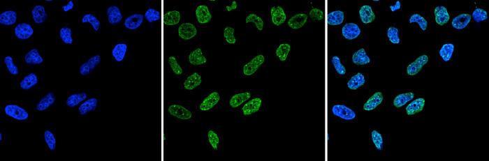 H3K9me3 Antibody validated in Immunofluorescence 