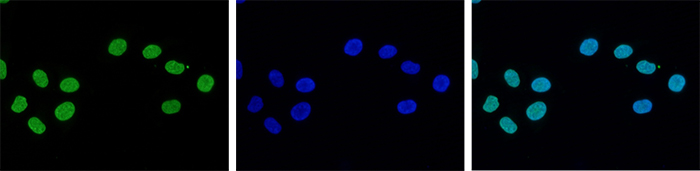 H3K27me3 Antibody Validation in Immunofluorescence 