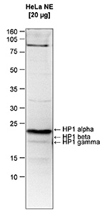 Western blot