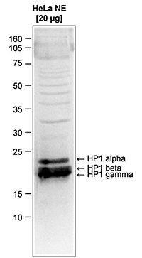 Western blot