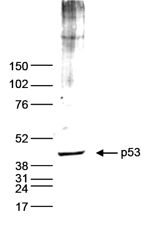 p53 Antibody validated in Western blot