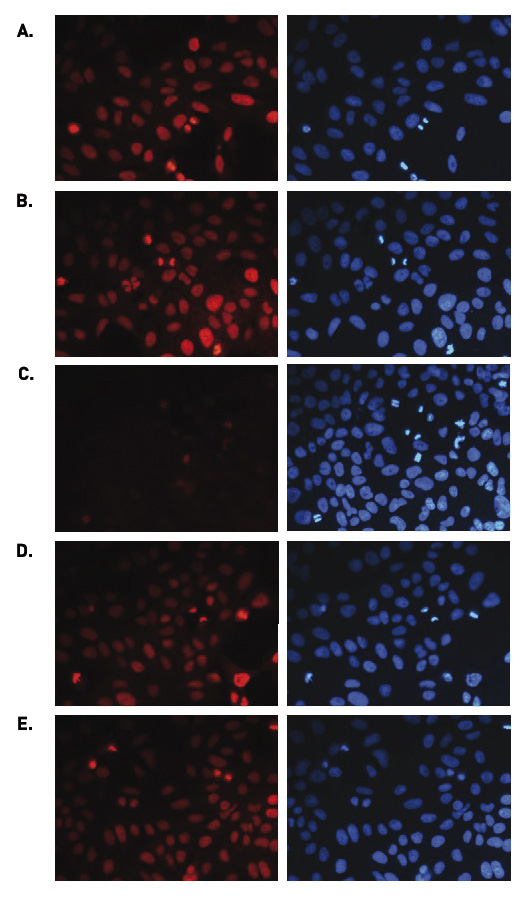 H3K36me1 Antibody validated in Immunofluorescence