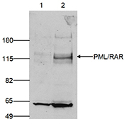 Western blot