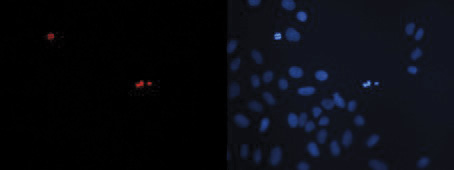 Immunofluorescence figure A