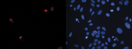 Immunofluorescence figure D