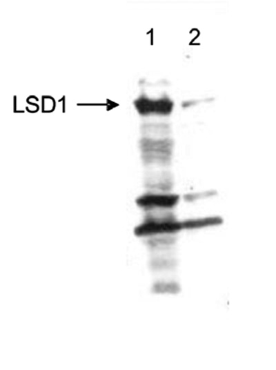 Western blot