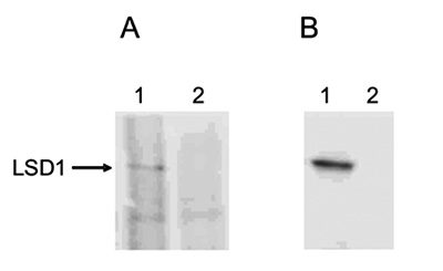 Immunoprecipitation and Western blot analysis