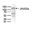 Western blot