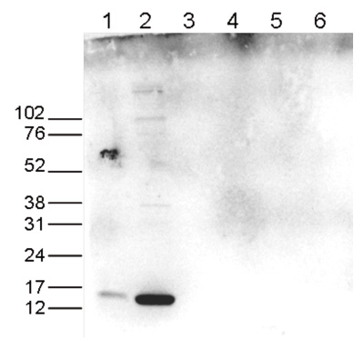 H3R17me2(asym)K18ac Antibody validated in Western Blot